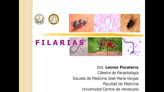 Filariasis linfática Wuchereria bancrofti  Mansonelosis [upl. by Laekcim]