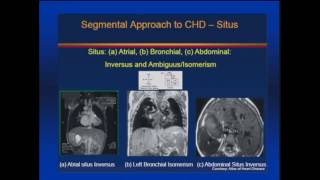 Fetal Echocardiography [upl. by Florin]