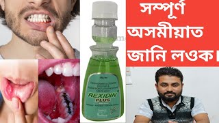 REXIDIN PLUS Mouthwash  Antiseptic  Anticaries Solution [upl. by Savvas851]