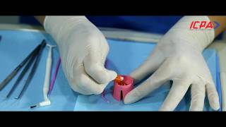 How to Apply Fluoride Varnish [upl. by Hsirrap]