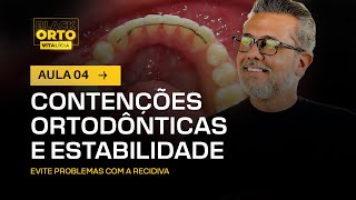 Aula 49  Contenções ortodônticas e estabilidade [upl. by Jahdiel]