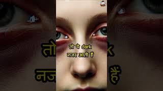 dark circles under eyes hindi [upl. by Shippee]