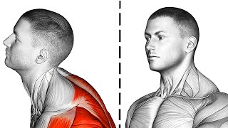 6 Exercises to Improve Forward Head Posture [upl. by Kahle]