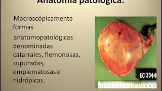 3 COLECISTITIS AGUDA primera parte [upl. by Rhee]