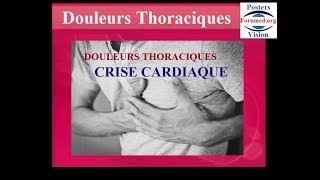 Reconnaitre une crise cardiaque des autres douleurs thoraciques symptomes [upl. by Elbam]