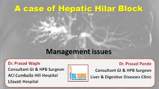 Casebased management of block at the liver hilum and hilar cholangiocarcinoma Bile duct cancer [upl. by Legnaesoj]