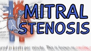 Disorder Mitral Stenosis  Information Causes Symptoms [upl. by Yendirb]