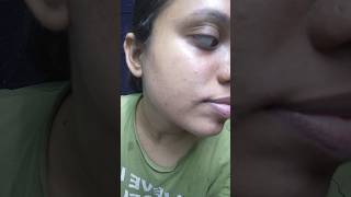 Watch this before using Tretinoin Skin transformation  Tretinoin 4 months update [upl. by Henricks]