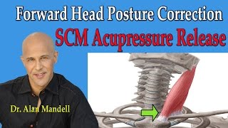 Forward Head Posture Correction SCM Acupressure Release  Dr Mandell [upl. by Ahtela]