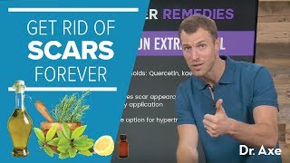 How to Get Rid of Scars Forever  Dr Josh Axe [upl. by Willie]