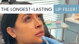 Volbella Lip Injections Can Last Up to a Whole Year [upl. by Penney]