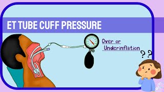 Endotracheal Cuff pressure Underinflation amp Overinflation [upl. by Wadsworth]