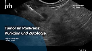 Pankreastumor Biopsie und Zytologie [upl. by Calbert]