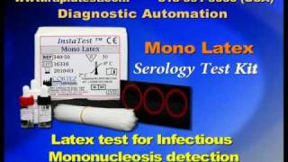 Mono Infectious Mononucleosis Serology kit [upl. by Edya569]