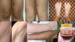 How To Lighten Your Dark Body Parts  Lighten Dark Knees Elbows amp Underarms [upl. by Yardley]