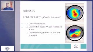 Modernas alternativas para la corrección del Queratocono [upl. by Mindi]