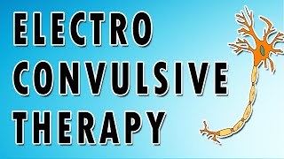 Electroconvulsive Therapy [upl. by Phionna71]