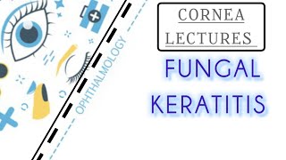 CORNEA LECTURE 6 FUNGAL KERATITIS [upl. by Berl]