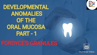 DEVELOPMENTAL ANOMALIES OF THE ORAL MUCOSA PART 1 FORDYCES GRANULES [upl. by Raclima]