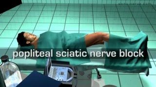 Popliteal Sciatic Nerve Block [upl. by Clarette]