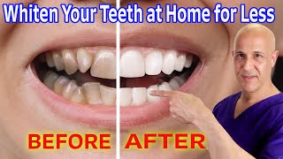 Whiten Your Teeth at Home for Nearly Free Dr Mandell [upl. by Eibo915]