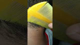 satisfying hair stitch hairstyle haircare fishing perfectedsheeran puppy edsheeranperfect [upl. by Reinaldos]