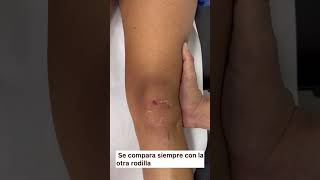 TEST LIGAMENTO COLATERAL MEDIAL shorts juancalbornoz colateral [upl. by Conni]