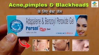 Persol Plus Gel Use in Hindi  Acnepimples Blackhead  Adapalene amp Benzoyl peroxide SK MEDICINE [upl. by Sucramat727]