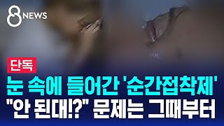 단독 눈 속에 들어간 순간접착제…quot안 된대quot 문제는 그때부터  SBS 8뉴스 [upl. by Berriman596]