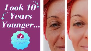 Look 10 Years Younger  About Fibroblast Rejuvenation Skin Tightening Treatments [upl. by Martin]