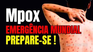 Mpox Emergência sanitária Global  Preparese [upl. by Ruosnam678]