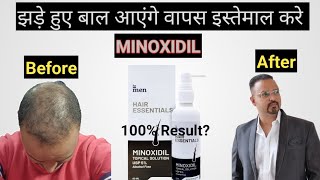 Use MINOXIDIL for hair regrowth understand full details [upl. by Ahidam]