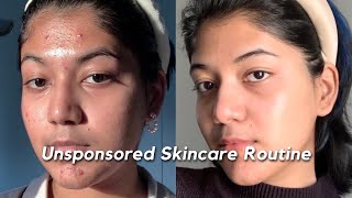 How I got rid of my ACNE SCARS amp TEXTURE  My Unsponsored Skincare Routine 🧴🫧🧖 [upl. by Madge516]