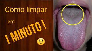 Como limpar a LÍNGUA e a SABURRA LINGUAL em 1 MINUTO [upl. by Onnem]