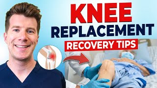 How to recover from KNEE REPLACEMENT SURGERY [upl. by Resneps]