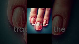 Fingernail Growth Faster Than Toenails Science Explained [upl. by Yhtomiht]