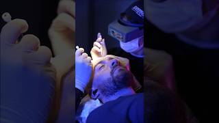 Cosmedica Clinic Hair Transplant in Turkey shorts hairtransplant video [upl. by Arabel373]