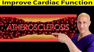 1 Amino AcidOpens Arteries Increase Blood Flow Helps Blood Pressure Improves Cardiac Function [upl. by Nodnal]