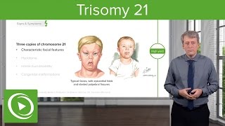 Trisomy 21 Down Syndrome Introduction – Pediatrics  Lecturio [upl. by Latoye]