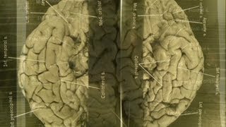 Images of Einsteins brain revealed [upl. by Dyane370]