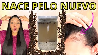 EL CABELLO CRECE COMO LOCO Y NO SE CAE😱 LA MEJOR RECETA DEL MUNDO PARA CRECER PELO😍FORMULA POTENTE [upl. by Aticilef]