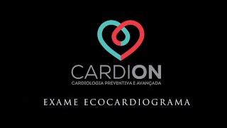 Exame de Ecocardiograma na clínica Cardion preparação e execução [upl. by Ras]