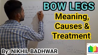 Bow Legs Meaning Causes and Treatment [upl. by Bunni]