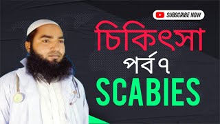 চিকিৎসা পর্বঃ  ৭  Scabies [upl. by Hi840]