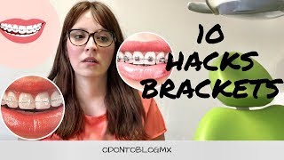 10 Hackstips para los que tienen brackets [upl. by Haret]