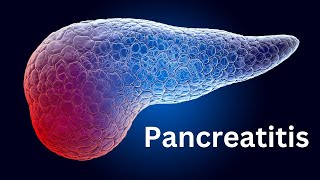 Pancreatitis Everything You Need To Know [upl. by Stiles]