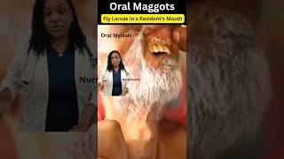 What is Oral Myiasis or Maggots in the Mouth [upl. by Akire]