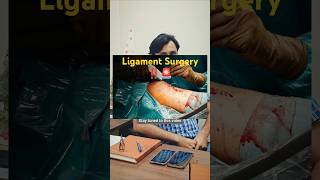 Ligament Surgery kis age group ko jyada jarurat hoti hai dailytips health doctor viralvideo [upl. by Bronnie209]