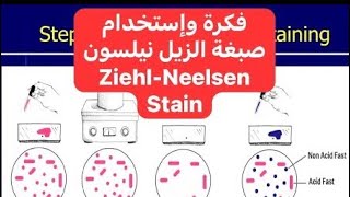 فكرة وإستخدام صبغة زيل نيلسون Principle and Use of Ziehl–Neelsen’s Stain [upl. by Haidej]