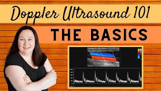 Doppler Ultrasound 101  The Basics [upl. by Clarey993]